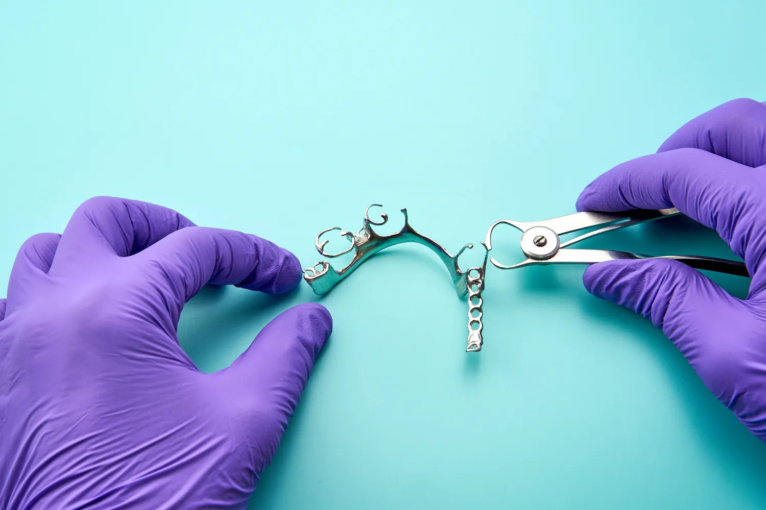 Dentysta Warszawa implanty